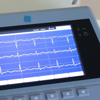 検査のイメージ